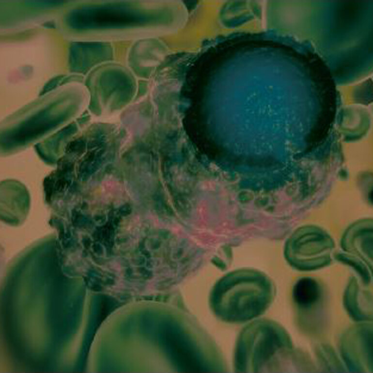 ESMO-Journals-Clinical-Lymphoma-Myeloma-Leukemia-1000x1000