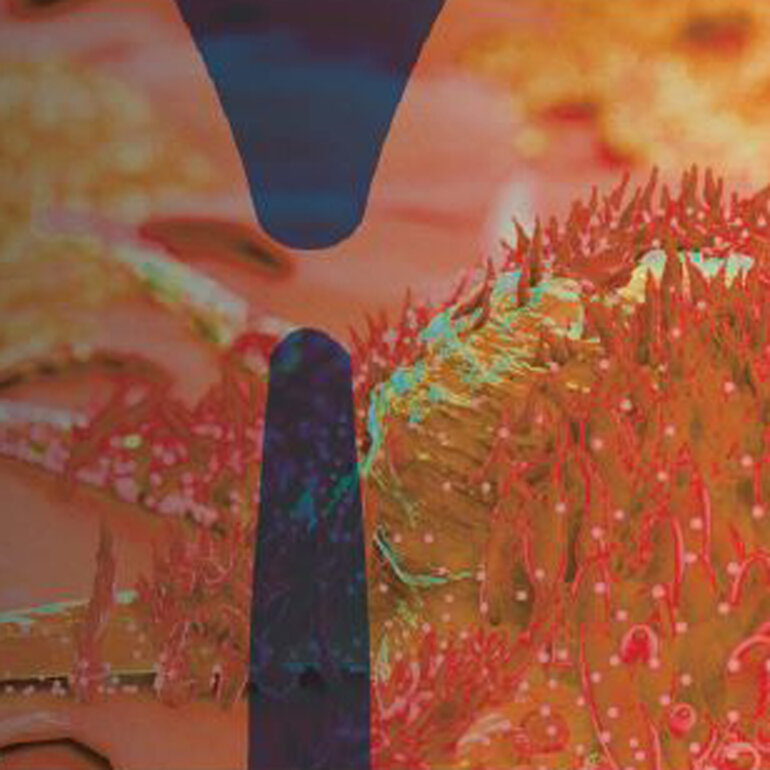 ESMO-Journals-Lung-Cancer-1000x1000