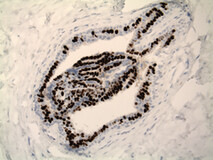 ER免疫正常管道