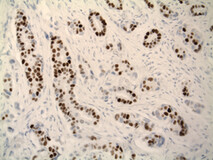 异异性免疫性ER