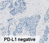 PD-L1负图
