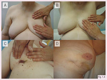 临床考试成像图1