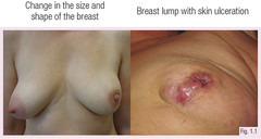 常见症状符号图